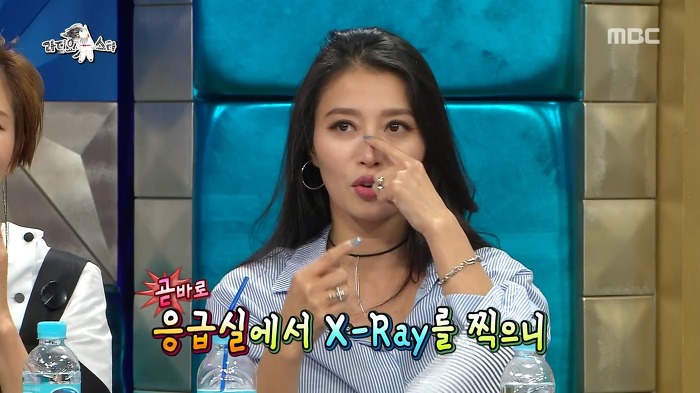 황보가 부러진 코뼈를 방치하는 이유.jpg | 인스티즈