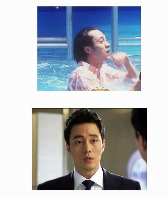 남자 연예인들의 탈모 극복 | 인스티즈